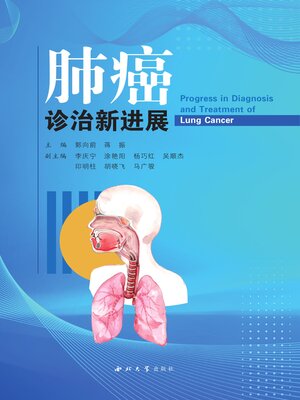 cover image of 肺癌诊治新进展